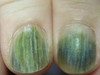 Синдром зеленых ногтей. №1861